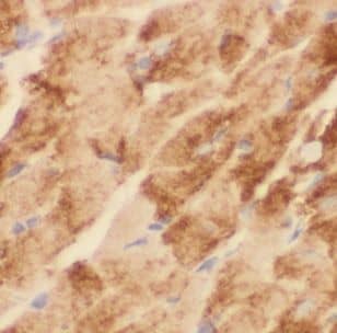 Immunohistochemistry: MT-ND2 Antibody - BSA Free [NBP3-47375] - Immunohistochemistry of paraffin-embedded human heart using (MT-ND2 antibody) at dilution of 1:50