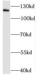 Western Blot: Sodium Calcium Exchanger 1/NCX1 Antibody - BSA Free [NBP3-47376] - Mouse brain tissue were subjected to SDS PAGE followed by western blot with ( Sodium Calcium Exchanger 1/NCX1