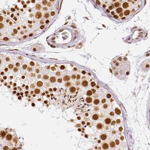 Immunohistochemistry HCAP-G Antibody - BSA Free