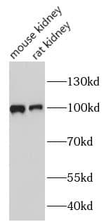 Western Blot: villin-like Antibody - BSA Free [NBP3-47383] - Various lysates were subjected to SDS PAGE followed by western blot with ( villin-like Antibody) at dilution of 1:1000.