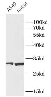 Western Blot: CCDC106 Antibody - BSA Free [NBP3-47385] - Various lysates were subjected to SDS PAGE followed by western blot with ( CCDC106 Antibody) at dilution of 1:1000.
