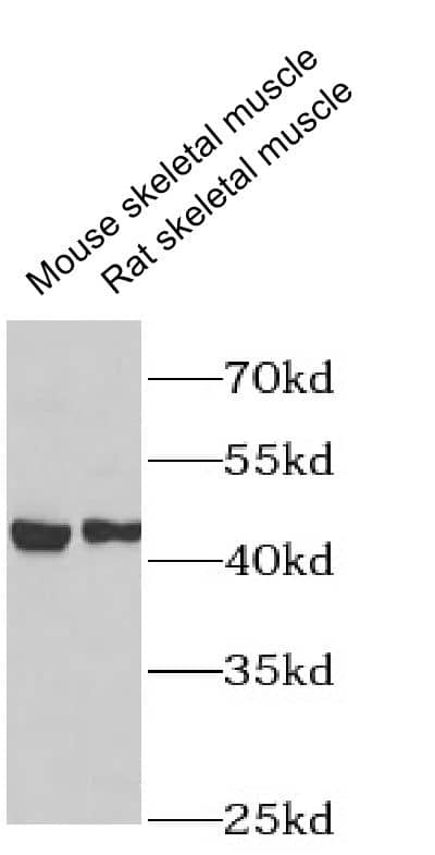 Western Blot: Nicotinic Acetylcholine Receptor epsilon Antibody - BSA Free [NBP3-47387] - Various lysates were subjected to SDS PAGE followed by western blot with ( Nicotinic Acetylcholine Receptor epsilon Antibody) at dilution of 1:1000.