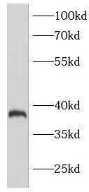 Western Blot: GPR78 Antibody - BSA Free [NBP3-47388] - Rat kidney were subjected to SDS PAGE followed by western blot with  at dilution of 1:1000.