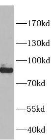 Western Blot: SLC26A3 Antibody - BSA Free [NBP3-47389] - NCI-H125 cells were subjected to SDS PAGE followed by western blot with FNab10913 at dilution of 1:1000.