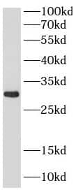 Western Blot: WBSCR27 Antibody - BSA Free [NBP3-47390] - HT-29 cells were subjected to SDS PAGE followed by western blot with (WBSCR27 Antibody) at dilution of 1:1000