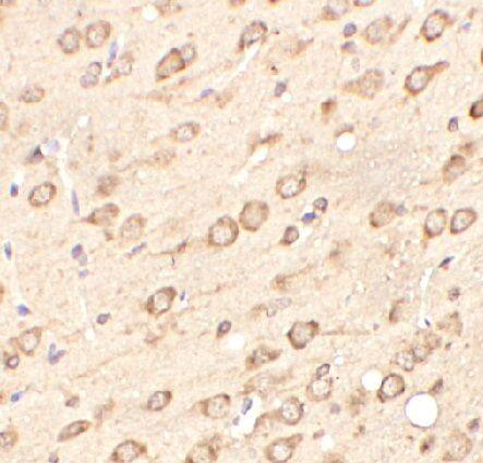 Immunohistochemistry: WBSCR27 Antibody - BSA Free [NBP3-47390] - Immunohistochemistry of paraffin-embedded mouse brain tissue using (WBSCR27 antibody) at dilution of 1:100