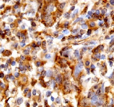 Immunohistochemistry WFDC12 Antibody - BSA Free
