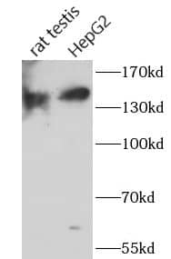 Western Blot: ST5 Antibody - BSA Free [NBP3-47396] - Various lysates were subjected to SDS PAGE followed by western blot with (ST5 antibody) at dilution of 1:1000
