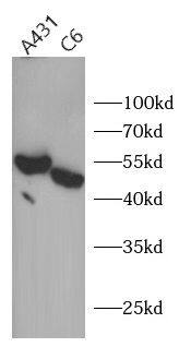 Western Blot: Suppressor of Fused Antibody - BSA Free [NBP3-47397] - Various lysates were subjected to SDS PAGE followed by western blot with (Suppressor of Fused antibody) at dilution of 1:1000
