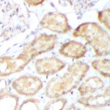 Immunohistochemistry: GADD34 Antibody - BSA Free [NBP3-47399] - Immunohistochemistry of paraffin-embedded human kidney using (GADD34 antibody) at dilution of 1:100