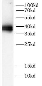 Western Blot: GADD34 Antibody - BSA Free [NBP3-47399] - Jurkat cell lysates were subjected to SDS PAGE followed by western blot with (GADD34 antibody) at dilution of 1:1000