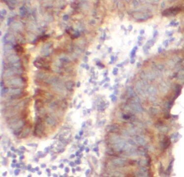 Immunohistochemistry: AGO1/EIF2C1 Antibody - BSA Free [NBP3-47402] - Immunohistochemistry of paraffin-embedded human colon using FNab0769(AGO1/EIF2C1 antibody) at dilution of 1:50