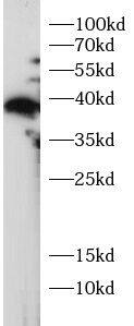 Western Blot: Myeloid leukemia factor 1 Antibody - BSA Free [NBP3-47404] - Mouse brain lysates were subjected to SDS PAGE followed by western blot with (Myeloid leukemia factor 1 antibody) at dilution of 1:1000