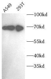 Western Blot: MAGED2 Antibody - BSA Free [NBP3-47405] - Various cell lysates were subjected to SDS PAGE followed by western blot with (MAGED2 antibody) at dilution of 1:1000