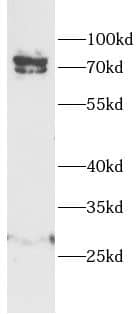Western Blot Proprotein convertase PC4 Antibody - BSA Free
