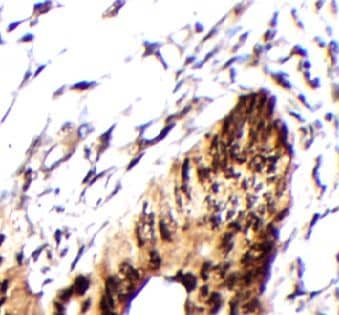 Immunohistochemistry WBSCR16 Antibody - BSA Free