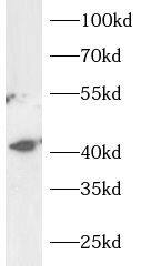 Western Blot WBSCR16 Antibody - BSA Free