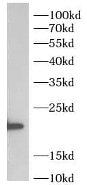 Western Blot UCK2 Antibody - BSA Free