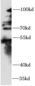 Western Blot: ZNF746 Antibody - BSA Free [NBP3-47410] - HepG2 cell lysates were subjected to SDS PAGE followed by western blot with (ZNF746 antibody) at dilution of 1:1000