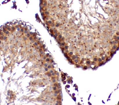 Immunohistochemistry: ZNF746 Antibody - BSA Free [NBP3-47410] - Immunohistochemistry of paraffin-embedded rat testis tissue slide using (ZNF746 antibody) at dilution of 1:100