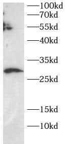 Western Blot: SECTM1 Antibody - BSA Free [NBP3-47412] - K562 cell lysates were subjected to SDS PAGE followed by western blot with (SECTM1 antibody) at dilution of 1:1000
