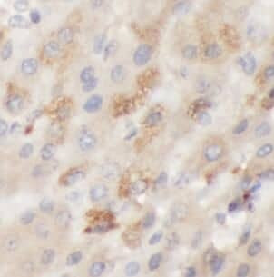 Immunohistochemistry: Galactosylceramidase/GALC Antibody - BSA Free [NBP3-47413] - Immunohistochemistry of paraffin-embedded human liver tissue slide using (Galactosylceramidase/GALC antibody) at dilution of 1:100
