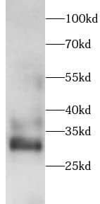 Western Blot: Galactosylceramidase/GALC Antibody - BSA Free [NBP3-47413] - Rat testis tissue were subjected to SDS PAGE followed by western blot with (Galactosylceramidase/GALC antibody) at dilution of 1:1000