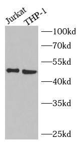Western Blot: NEU3 Antibody - BSA Free [NBP3-47419] - Various lysates were subjected to SDS PAGE followed by western blot with (NEU3 Antibody) at dilution of 1:1000
