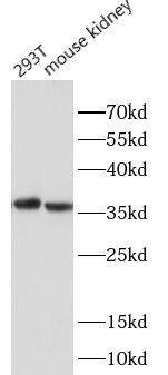 Western Blot: Aldo-keto Reductase 1B10/AKR1B10 Antibody - BSA Free [NBP3-47425] - Various cell lysates were subjected to SDS PAGE followed by western blot with (Aldo-keto Reductase 1B10/AKR1B10 antibody) at dilution of 1:1000