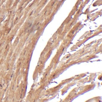 Immunohistochemistry: SCN7A Antibody - BSA Free [NBP3-47426] - Immunohistochemistry of paraffin-embedded mouse heart tissue slide using (SCN7A Antibody) at dilution of 1:100