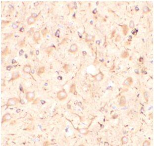 Immunohistochemistry: KISS1 Antibody - BSA Free [NBP3-47428] - Immunohistochemistry of paraffin-embedded rat brain tissue slide using (KISS1 Antibody) at dilution of 1:100