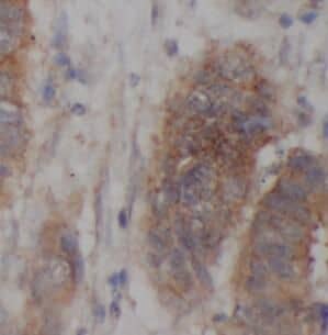 Immunohistochemistry COL14A1 Antibody - BSA Free