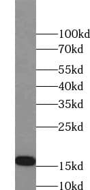 Western Blot: Orexin Antibody - BSA Free [NBP3-47433] - Mouse liver tissue were subjected to SDS PAGE followed by western blot with (Orexin antibody) at dilution of 1:1000