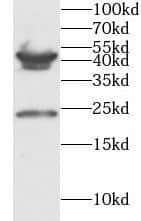 Western Blot: PMCH Antibody - BSA Free [NBP3-47434] - Mouse liver tissue were subjected to SDS PAGE followed by western blot with (PMCH antibody) at dilution of 1:1000