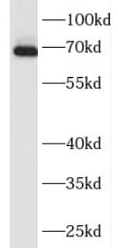 Western Blot: FAM171A2 Antibody - BSA Free [NBP3-47438] - HepG2 cells were subjected to SDS PAGE followed by western blot with (FAM171A2 Antibody) at dilution of 1:600.