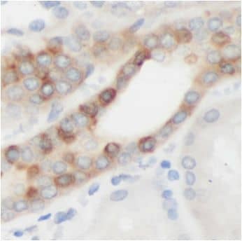 Immunohistochemistry: ACOXL Antibody - BSA Free [NBP3-47439] - Immunohistochemistry of paraffin-embedded human kidney tissue slide using (ACOXL Antibody) at dilution of 1:50