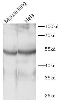 Western Blot: ACOXL Antibody - BSA Free [NBP3-47439] - Various lysates were subjected to SDS PAGE followed by western blot with (ACOXL antibody) at dilution of 1:1000