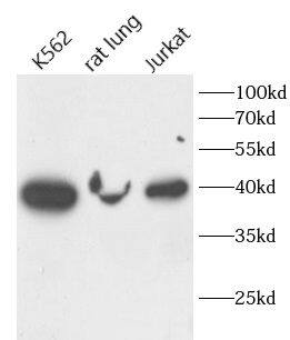 Western Blot: Fucosyltransferase 2/FUT2 Antibody - BSA Free [NBP3-47448] - Various lysates were subjected to SDS PAGE followed by western blot with (Fucosyltransferase 2/FUT2 antibody) at dilution of 1:1000