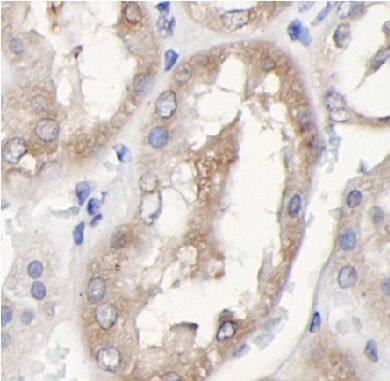 Immunohistochemistry: Spt6 Antibody - BSA Free [NBP3-47449] - Immunohistochemistry of paraffin-embedded human kidney using (Spt6 antibody) at dilution of 1:100