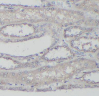 Immunohistochemistry: MRP6 Antibody - BSA Free [NBP3-47452] - Immunohistochemistry of paraffin-embedded human kidney slide using (MRP6 Antibody) at dilution of 1:100