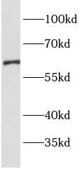 Western Blot: OAT1 Antibody - BSA Free [NBP3-47456] - Mouse kidney tissue were subjected to SDS PAGE followed by western blot with (OAT1 antibody) at dilution of 1:1000