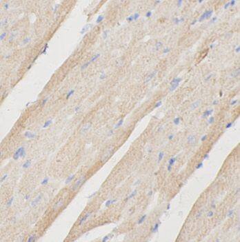 Immunohistochemistry: FUCA2 Antibody - BSA Free [NBP3-47458] - Immunohistochemistry of paraffin-embedded mouse heart tissue slide using (FUCA2 antibody) at dilution of 1:200