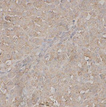 Immunohistochemistry: Complement C8A Antibody - BSA Free [NBP3-47462] - Immunohistochemistry of paraffin-embedded Rat liver tissue slide using (Complement C8A antibody) at dilution of 1:200