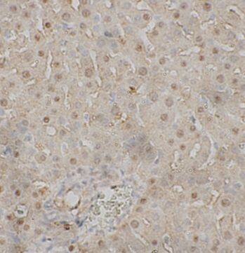 Immunohistochemistry: C8B Antibody - BSA Free [NBP3-47464] - Immunohistochemistry of paraffin-embedded Rat liver tissue slide using (C8B antibody) at dilution of 1:200