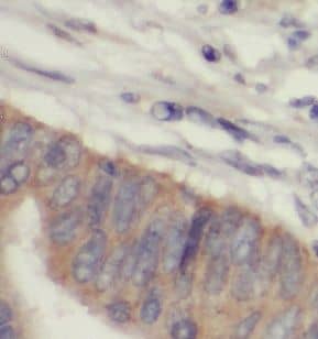 Immunohistochemistry PTPN3 Antibody - BSA Free