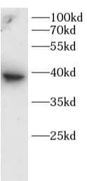 Western Blot: MOK Antibody - BSA Free [NBP3-47469] - HeLa cells were subjected to SDS PAGE followed by western blot with (MOK antibody) at dilution of 1:1000