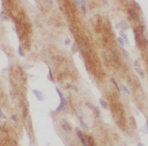 Immunohistochemistry MOK Antibody - BSA Free
