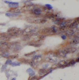 Immunohistochemistry DNA2 Antibody - BSA Free