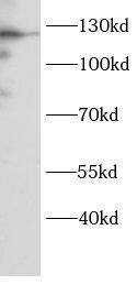 Western Blot DNA2 Antibody - BSA Free