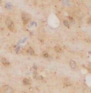 Immunohistochemistry: mGluR4 Antibody - BSA Free [NBP3-47474] - Immunohistochemistry of paraffin-embedded rat brain using (mGluR4 antibody) at dilution of 1:100